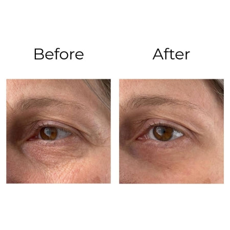 Peptilux Crème Contour des Yeux Anti-Rides 20 ml