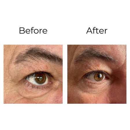 Peptilux Crème Contour des Yeux Anti-Rides 20 ml